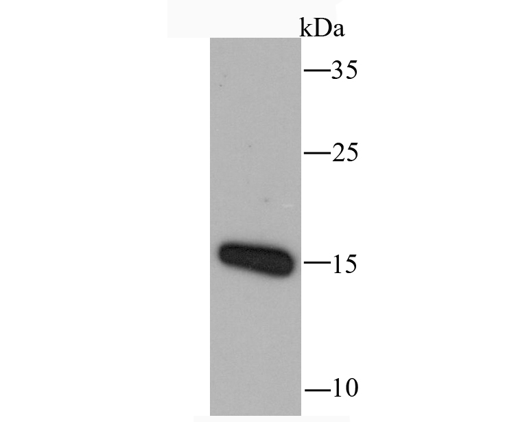Rabbit anti-CCL5 Recombinant Monoclonal Antibody
