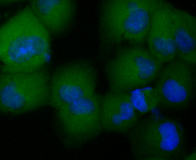 Rabbit anti-CCL5 Recombinant Monoclonal Antibody