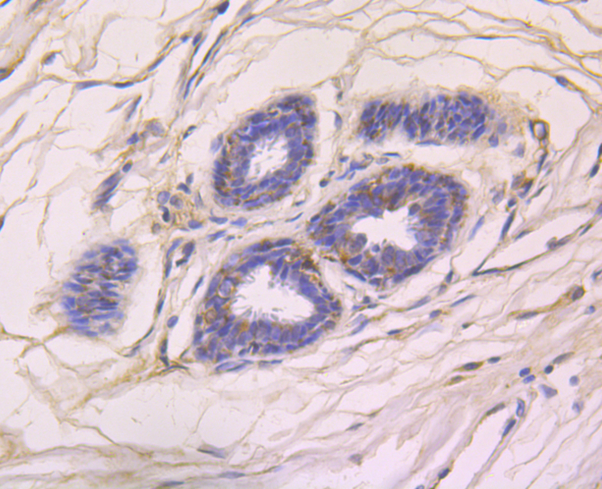 Rabbit anti-CCL5 Recombinant Monoclonal Antibody