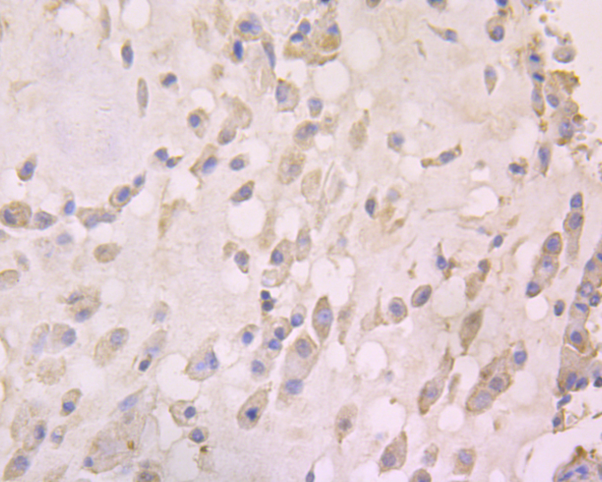 Rabbit anti-CCL5 Recombinant Monoclonal Antibody