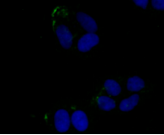 Rabbit anti-JAK3 Recombinant Monoclonal Antibody