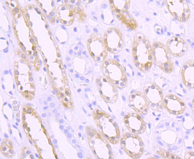 Rabbit anti-SPHK1 Recombinant Monoclonal Antibody