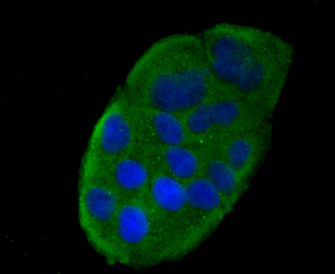 Rabbit anti-CCL5 Recombinant Monoclonal Antibody