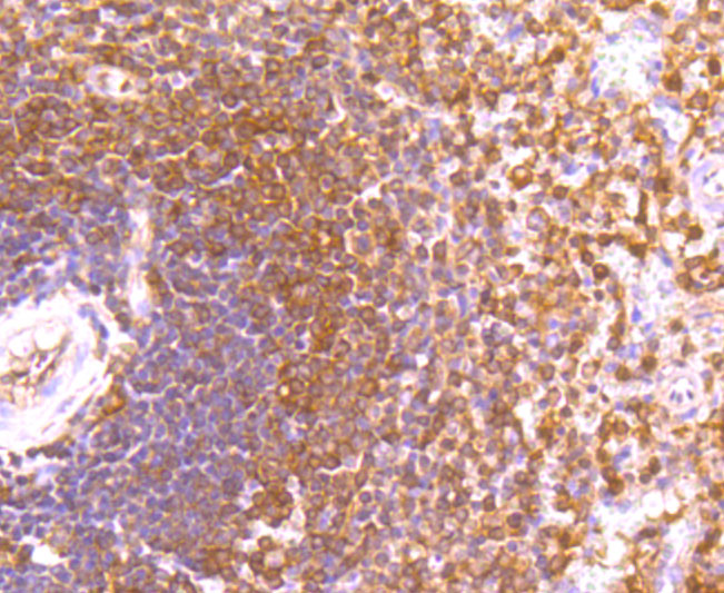 Rabbit anti-ETS1 Recombinant Monoclonal Antibody