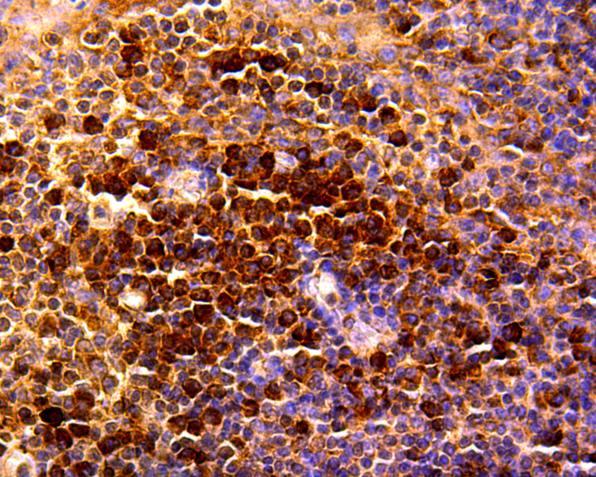 Rabbit anti-CCL5 Recombinant Monoclonal Antibody