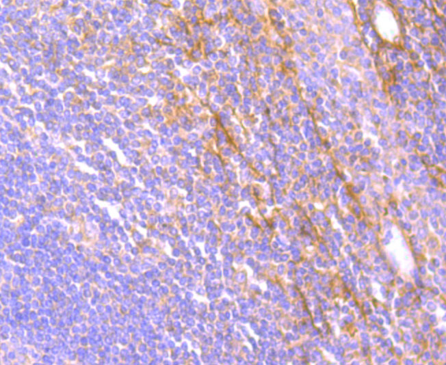 Rabbit anti-JAK3 Recombinant Monoclonal Antibody
