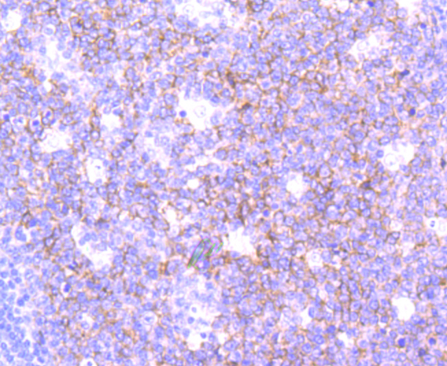 Rabbit anti-SNAP23 Recombinant Monoclonal Antibody