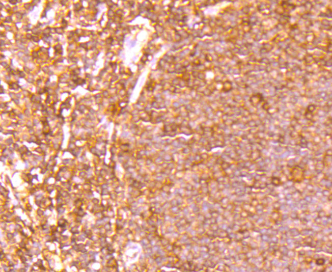 Rabbit anti-ETS1 Recombinant Monoclonal Antibody