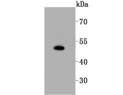 Rabbit anti-SPHK1 Recombinant Monoclonal Antibody
