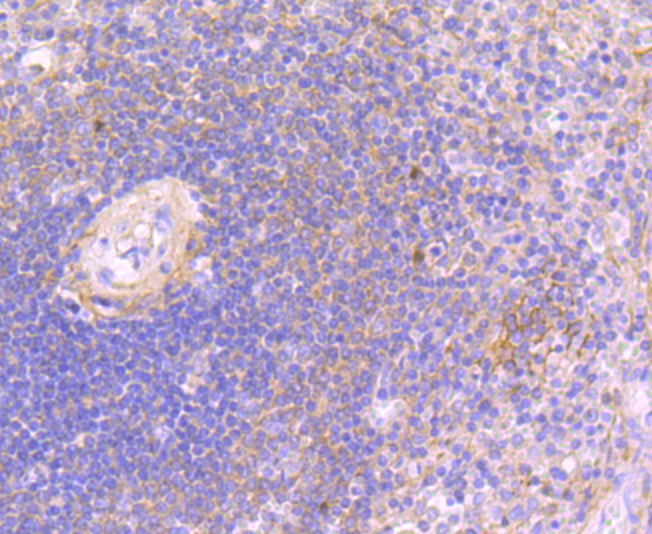 Rabbit anti-JAK3 Recombinant Monoclonal Antibody