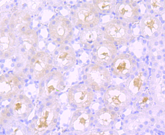 Rabbit anti-SPHK1 Recombinant Monoclonal Antibody