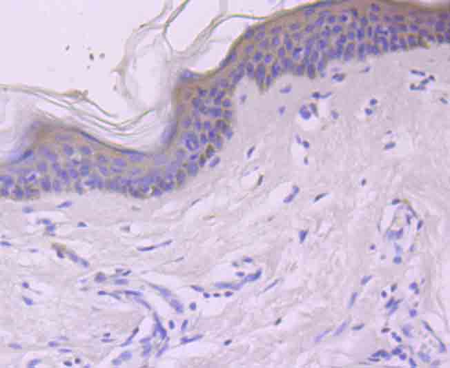 Rabbit anti-REL Recombinant Monoclonal Antibody
