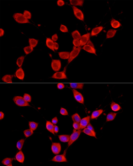 Rabbit anti-YTHDF3 Polyclonal Antibody