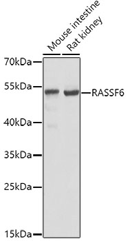 Rabbit anti-RASSF6 Polyclonal Antibody