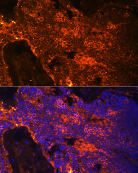 Rabbit anti-SPTA1 Polyclonal Antibody