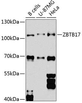 Rabbit anti-ZBTB17 Polyclonal Antibody