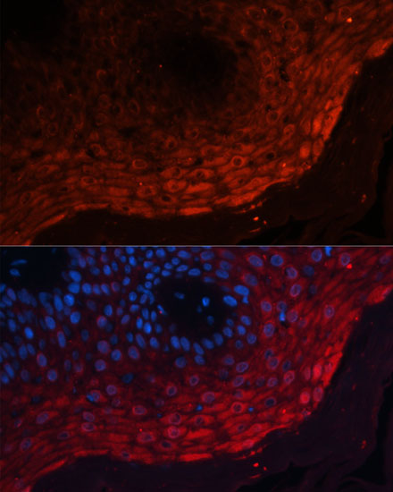 Rabbit anti-S100A8 Polyclonal Antibody