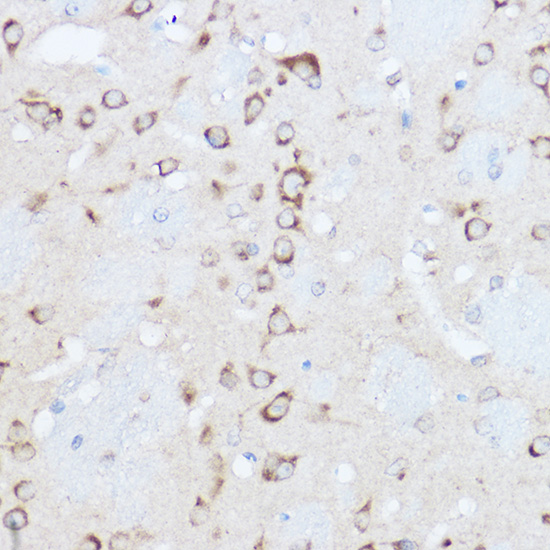 Rabbit anti-YTHDF3 Polyclonal Antibody