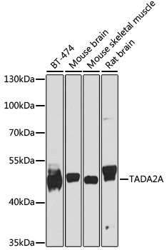 Rabbit anti-TADA2A Polyclonal Antibody