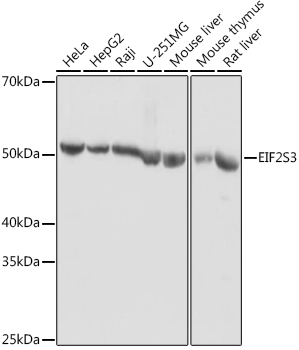 Rabbit anti-EIF2S3 Polyclonal Antibody