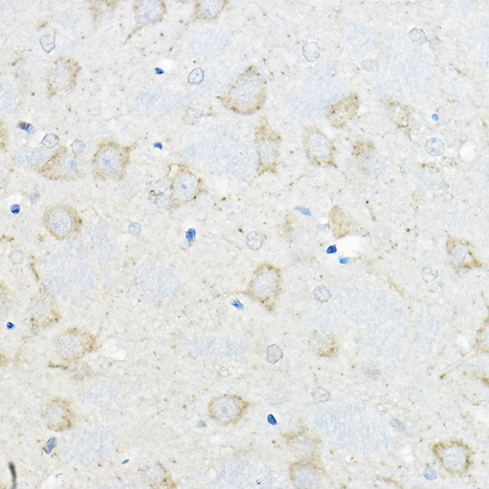 Rabbit anti-GIPR Polyclonal Antibody