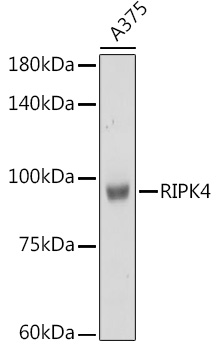 Rabbit anti-RIPK4 Polyclonal Antibody