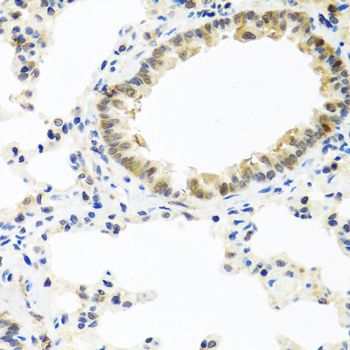 Rabbit anti-BMP5 Polyclonal Antibody