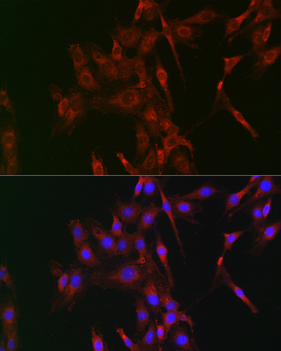 Rabbit anti-LOX Polyclonal Antibody