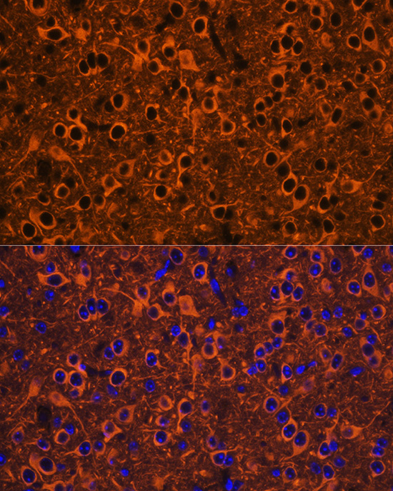 Rabbit anti-βIII-Tubulin Polyclonal Antibody