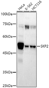 Rabbit anti-SKP2 Polyclonal Antibody