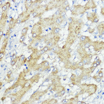 Rabbit anti-SOCS6 Polyclonal Antibody