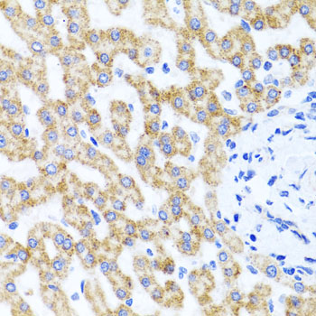 Rabbit anti-RIPK4 Polyclonal Antibody