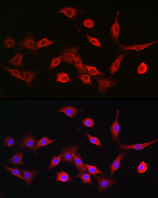 Rabbit anti-TAP2 Polyclonal Antibody