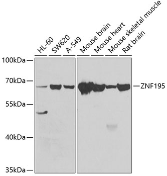 Rabbit anti-ZNF195 Polyclonal Antibody