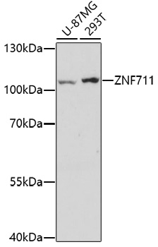 Rabbit anti-ZNF711 Polyclonal Antibody