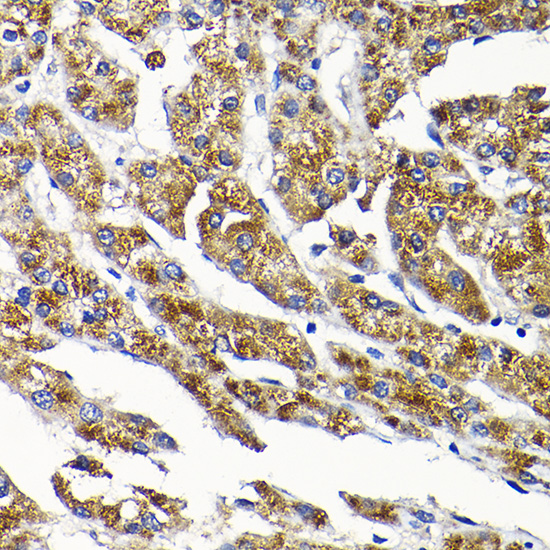 Rabbit anti-SCFD1 Polyclonal Antibody
