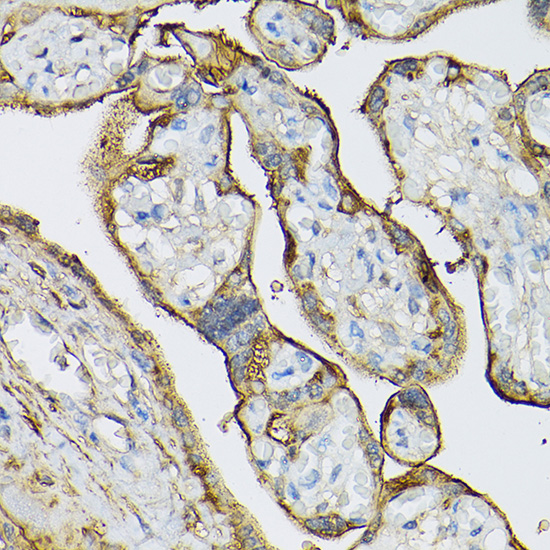 Rabbit anti-TGM2 Polyclonal Antibody