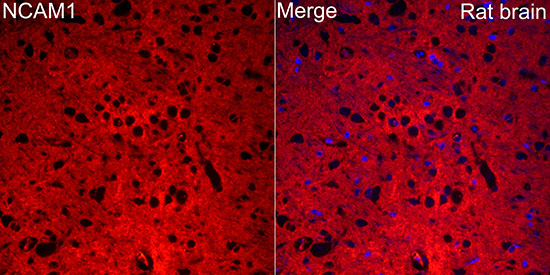 Rabbit anti-NCAM1 Polyclonal Antibody