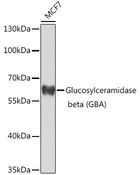 Rabbit anti-GBA Polyclonal Antibody
