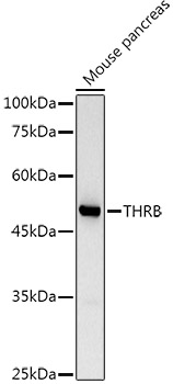 Rabbit anti-THRB Polyclonal Antibody