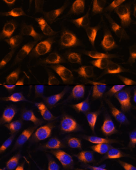 Rabbit anti-VAT1 Polyclonal Antibody