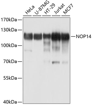 Rabbit anti-NOP14 Polyclonal Antibody