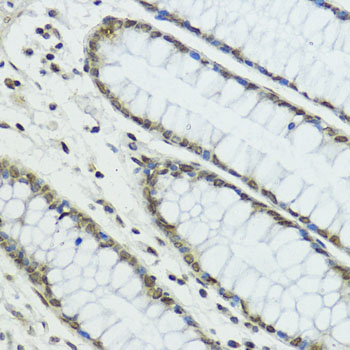 Rabbit anti-TRIP12 Polyclonal Antibody