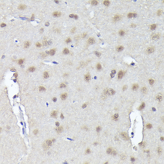 Rabbit anti-CRCP Polyclonal Antibody