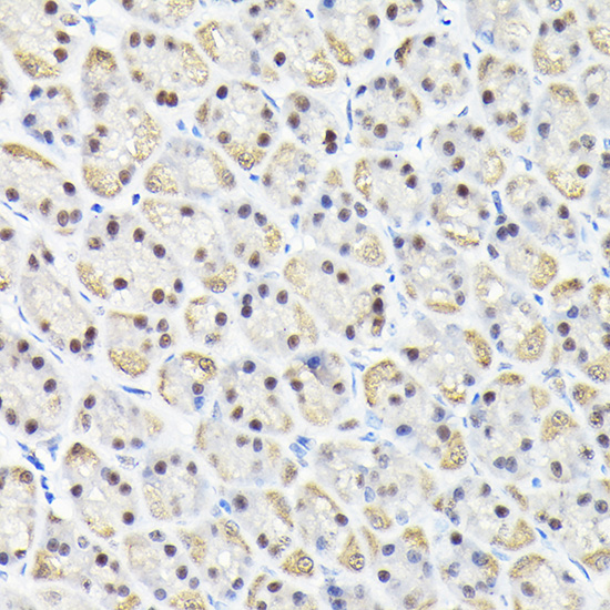 Rabbit anti-KPNA3 Polyclonal Antibody