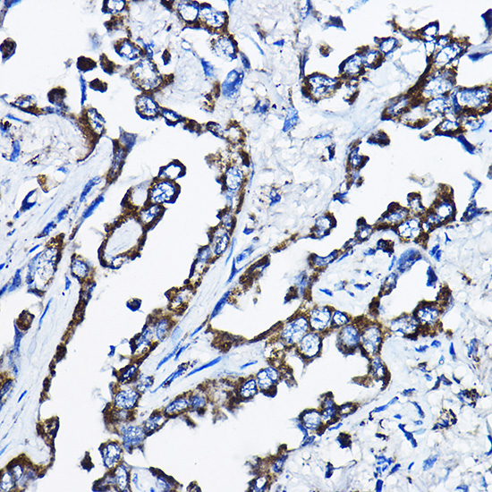 Rabbit anti-MSRB2 Polyclonal Antibody