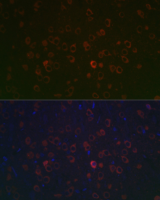 Rabbit anti-REEP2 Polyclonal Antibody