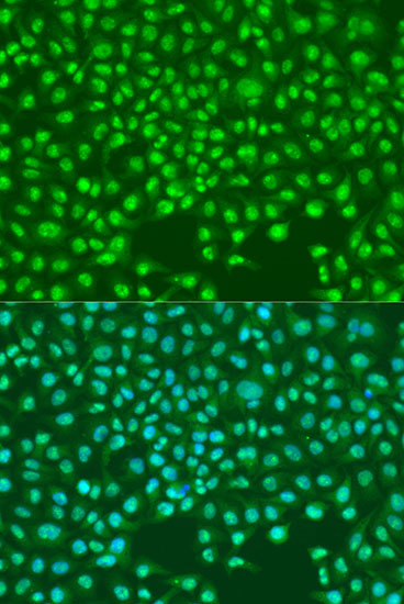 Rabbit anti-SKP2 Polyclonal Antibody