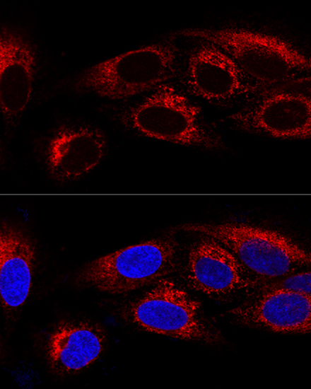 Rabbit anti-CKAP4 Polyclonal Antibody