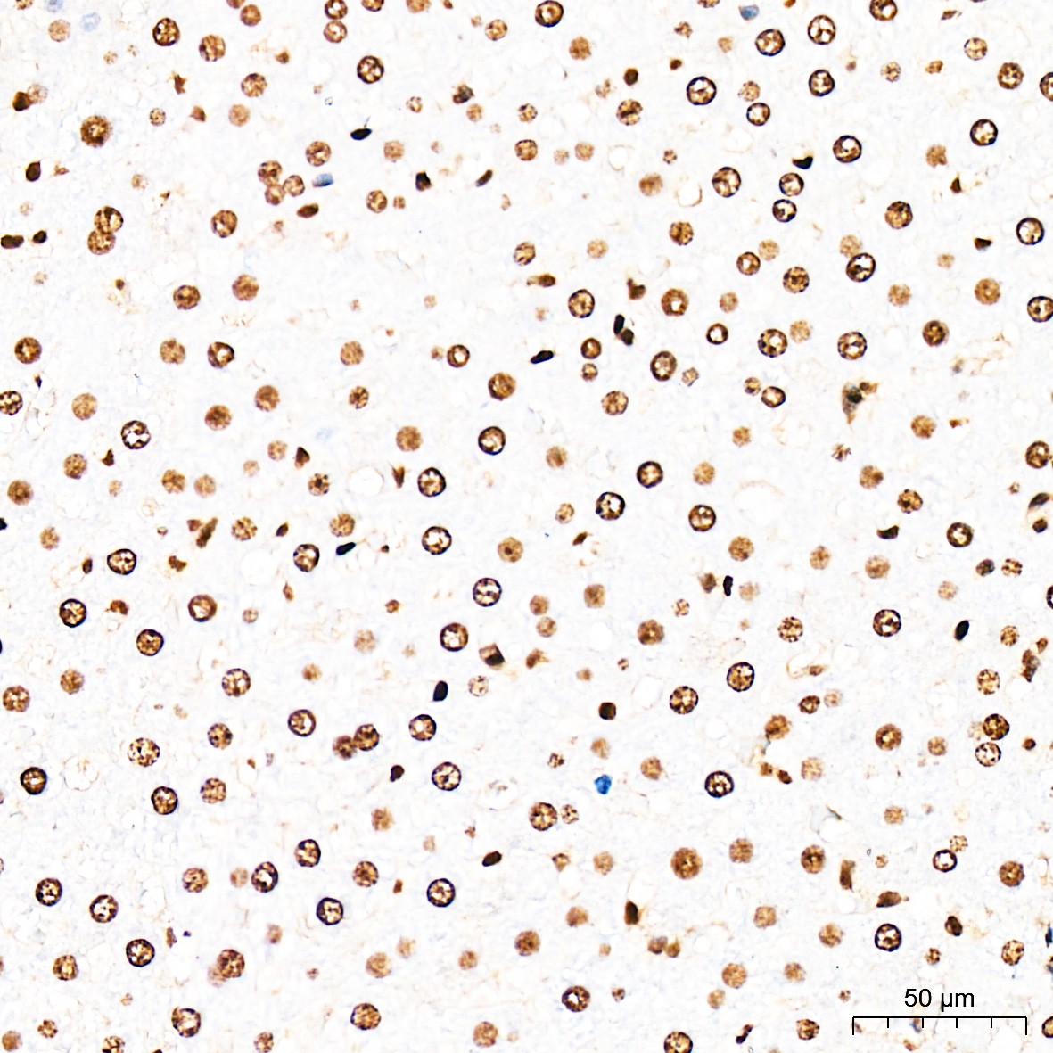 Rabbit anti-HMGB1 Polyclonal Antibody